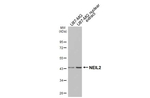 NEIL2 Antibody in Western Blot (WB)
