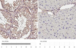 P2X3 Recombinant Rabbit Monoclonal Antibody (HL3347)