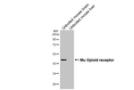 OPRM1 Recombinant Rabbit Monoclonal Antibody (HL3348)