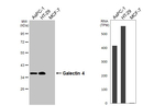 Galectin 4 Recombinant Rabbit Monoclonal Antibody (HL3349)