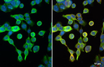 Galectin 4 Recombinant Rabbit Monoclonal Antibody (HL3350)