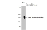 Phospho-EGFR (Tyr1045) Antibody in Western Blot (WB)