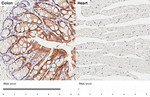 IL1RA Recombinant Rabbit Monoclonal Antibody (HL3369)
