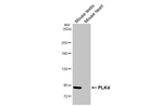 PLK4 Antibody in Western Blot (WB)