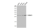 VDAC Recombinant Rabbit Monoclonal Antibody (HL3373)
