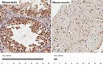 SUFU Antibody in Immunohistochemistry (Paraffin) (IHC (P))