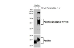 Phospho-Paxillin (Tyr118) Antibody in Western Blot (WB)