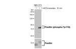 Phospho-Paxillin (Tyr118) Recombinant Rabbit Monoclonal Antibody (HL3384)
