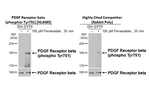 Phospho-PDGFRB (Tyr751) Antibody in Western Blot (WB)