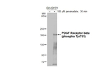Phospho-PDGFRB (Tyr751) Antibody in Western Blot (WB)