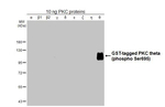 Phospho-PKC theta (Ser695) Antibody in Western Blot (WB)