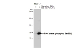 Phospho-PKC theta (Ser695) Recombinant Rabbit Monoclonal Antibody (HL3397)