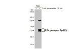 Phospho-BTK (Tyr223) Recombinant Rabbit Monoclonal Antibody (HL3403)
