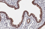 ESRP1 Antibody in Immunohistochemistry (Paraffin) (IHC (P))