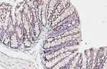 ESRP1 Antibody in Immunohistochemistry (Paraffin) (IHC (P))