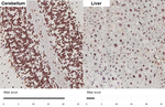 RAD21 Antibody in Immunohistochemistry (Paraffin) (IHC (P))