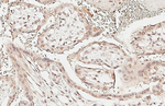 RAD21 Antibody in Immunohistochemistry (Paraffin) (IHC (P))