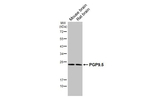 PGP9.5 Antibody in Western Blot (WB)