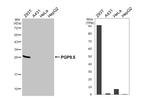 PGP9.5 Antibody in Western Blot (WB)