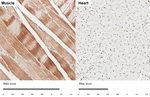 HDAC4 Antibody in Immunohistochemistry (Paraffin) (IHC (P))