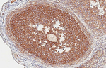 HDAC4 Antibody in Immunohistochemistry (Paraffin) (IHC (P))