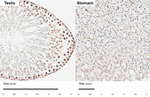 POLR3A Antibody in Immunohistochemistry (Paraffin) (IHC (P))