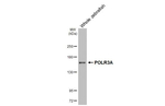 POLR3A Antibody in Western Blot (WB)