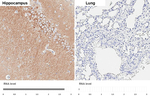 WAVE1 Antibody in Immunohistochemistry (Paraffin) (IHC (P))