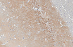 WAVE1 Antibody in Immunohistochemistry (Paraffin) (IHC (P))