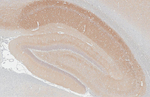 WAVE1 Antibody in Immunohistochemistry (Paraffin) (IHC (P))