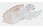 WAVE1 Antibody in Immunohistochemistry (Paraffin) (IHC (P))