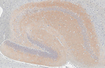 WAVE1 Antibody in Immunohistochemistry (Paraffin) (IHC (P))