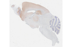 WAVE1 Antibody in Immunohistochemistry (Paraffin) (IHC (P))