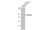 PIKFYVE Antibody in Western Blot (WB)