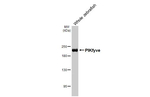PIKFYVE Antibody in Western Blot (WB)