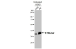 ST3GAL2 Recombinant Rabbit Monoclonal Antibody (HL3457)