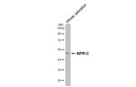 NPR3 Antibody in Western Blot (WB)