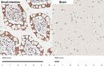 HKDC1 Antibody in Immunohistochemistry (Paraffin) (IHC (P))