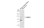 HKDC1 Antibody in Western Blot (WB)