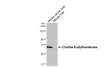 ChAT Antibody in Western Blot (WB)