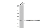 ChAT Antibody in Western Blot (WB)