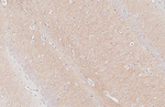 GEF-H1 Antibody in Immunohistochemistry (Paraffin) (IHC (P))