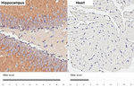 GEF-H1 Antibody in Immunohistochemistry (Paraffin) (IHC (P))