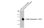 SLC6A1 Antibody in Western Blot (WB)