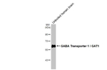 SLC6A1 Antibody in Western Blot (WB)