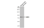 ZER1 Antibody in Western Blot (WB)