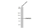 XPNPEP2 Antibody in Western Blot (WB)