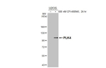 PLK4 Antibody in Western Blot (WB)
