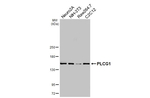 PLCG1 Recombinant Rabbit Monoclonal Antibody (HL3508)