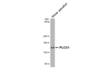 PLCG1 Antibody in Western Blot (WB)